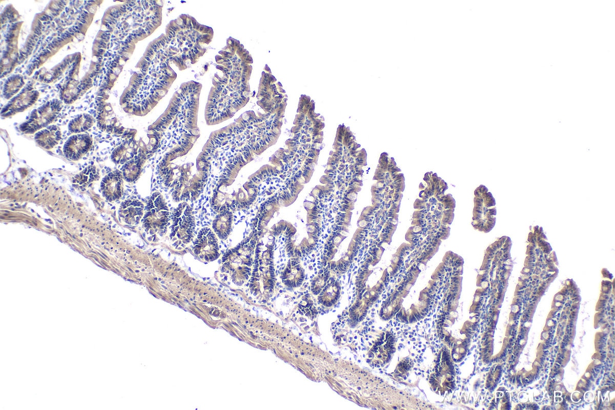 Immunohistochemical analysis of paraffin-embedded rat small intestine tissue slide using KHC1930 (CHMP4B IHC Kit).