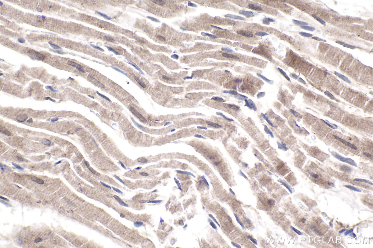 Immunohistochemical analysis of paraffin-embedded rat heart tissue slide using KHC1930 (CHMP4B IHC Kit).