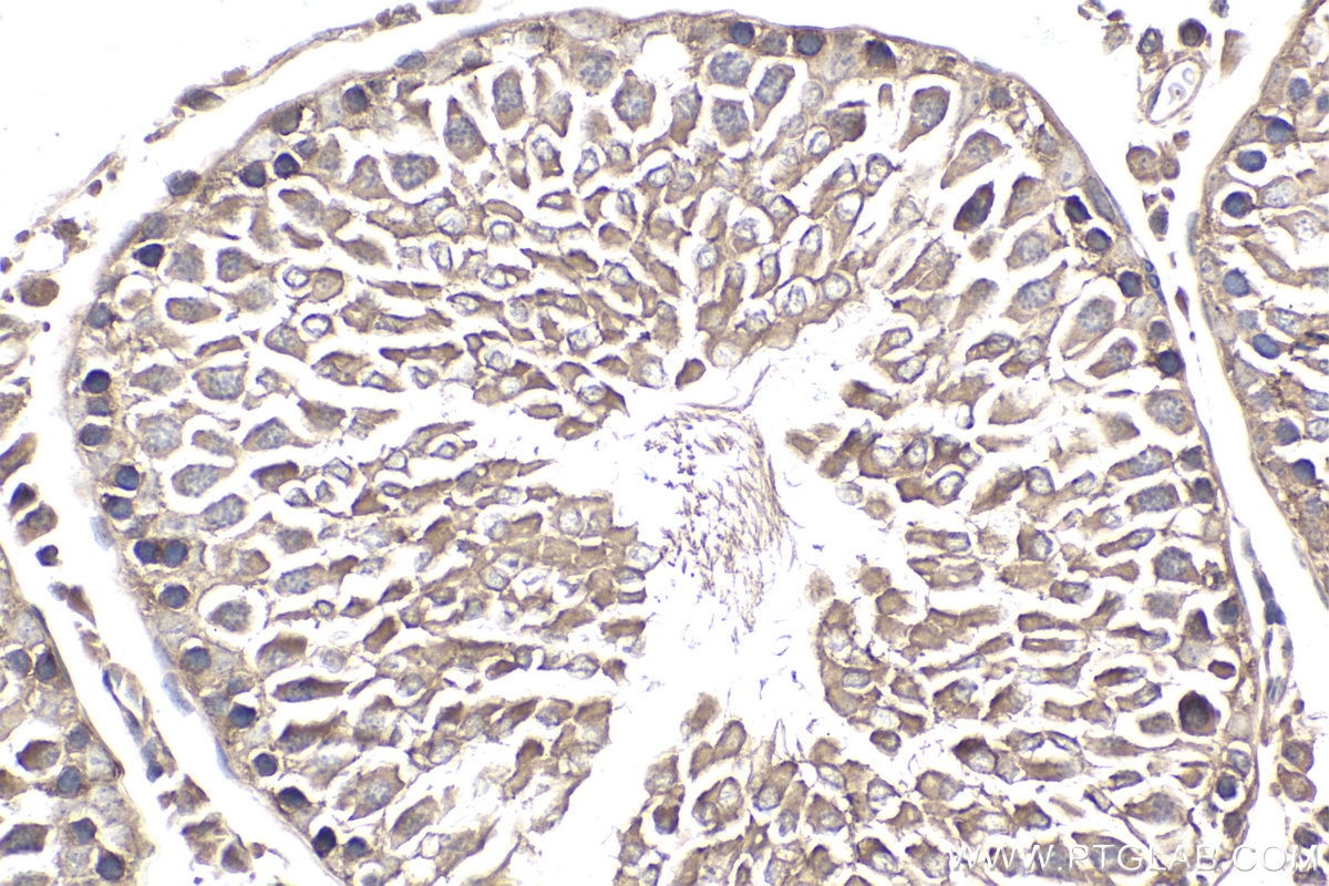 Immunohistochemical analysis of paraffin-embedded rat testis tissue slide using KHC1898 (CIB1 IHC Kit).