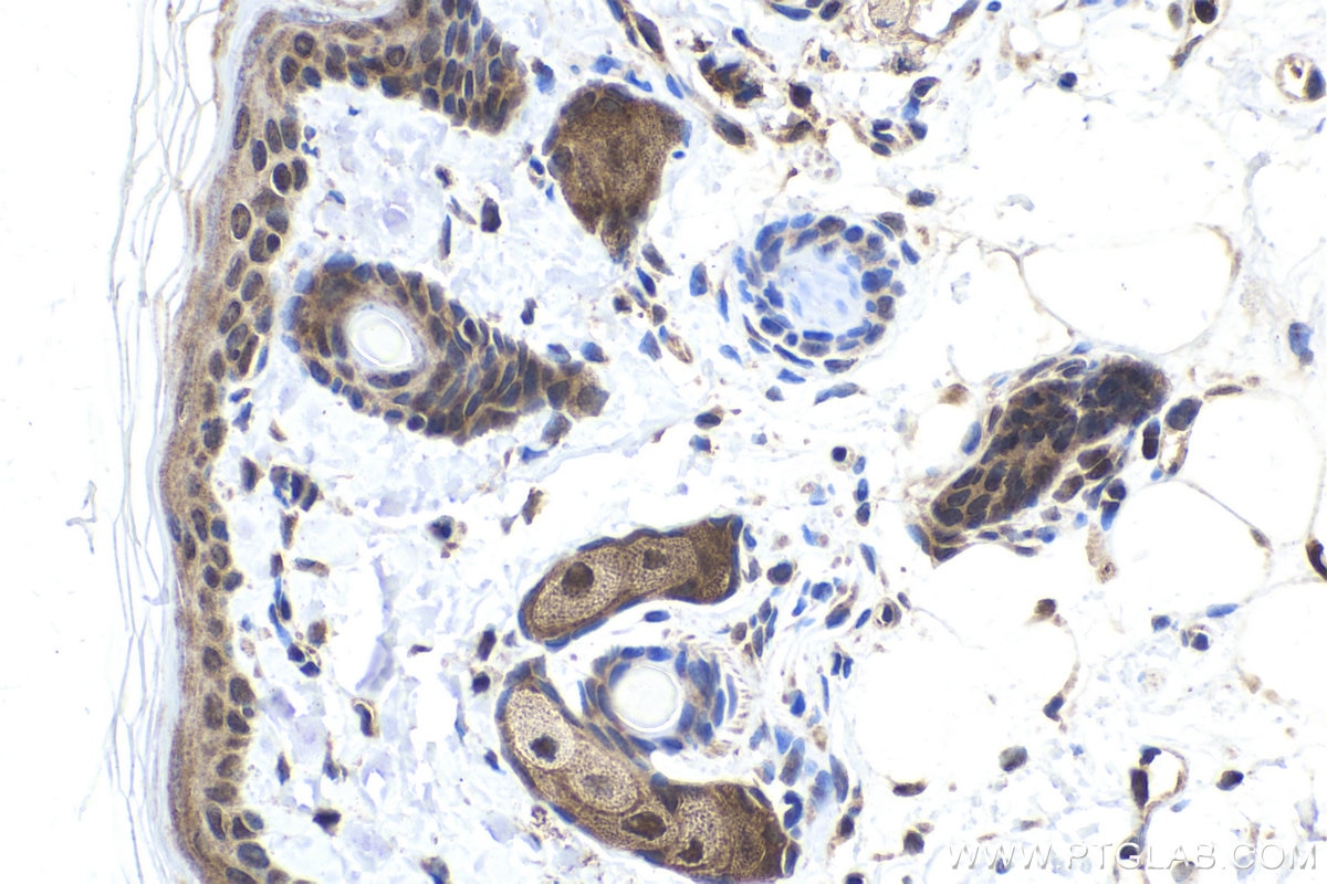 Immunohistochemical analysis of paraffin-embedded rat skin tissue slide using KHC1898 (CIB1 IHC Kit).