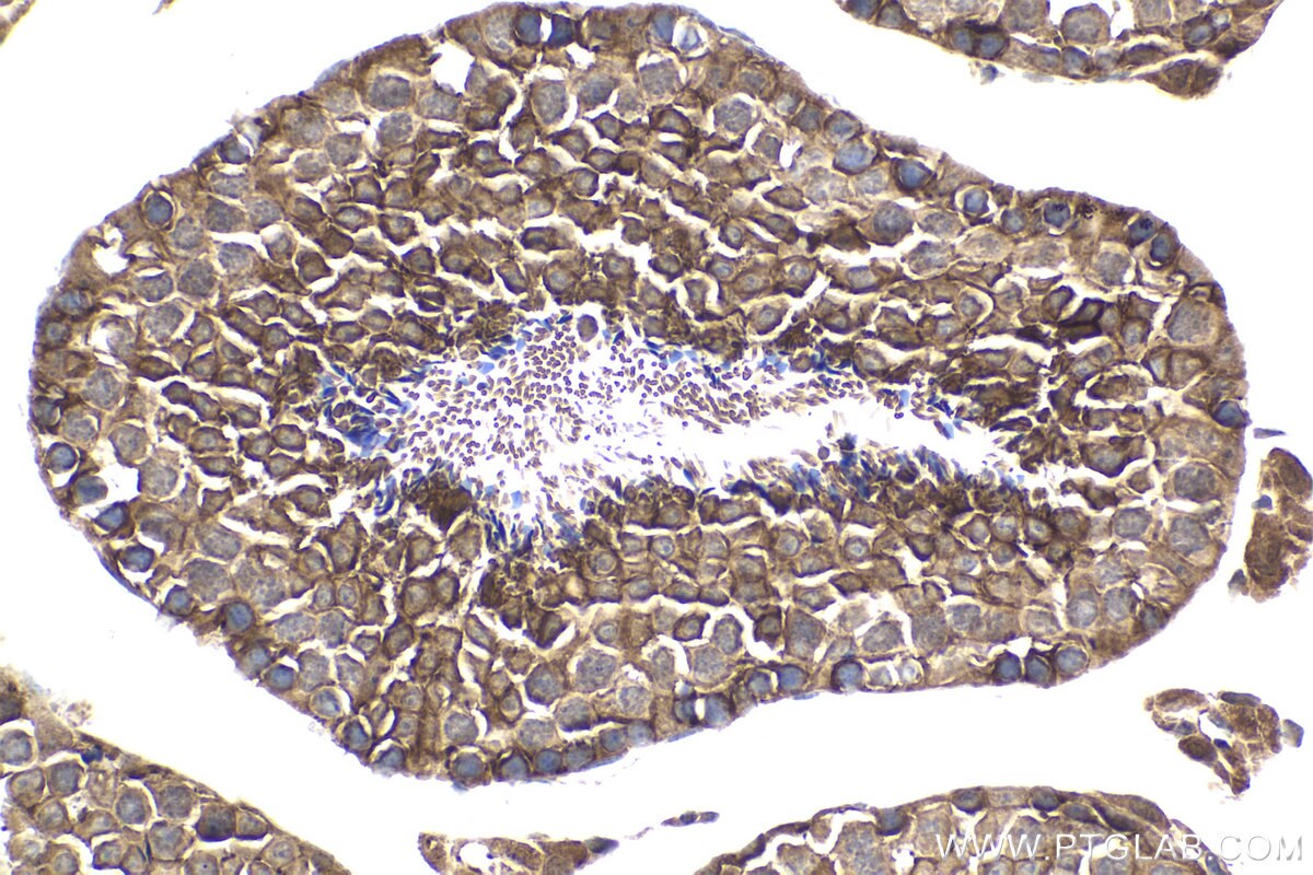Immunohistochemical analysis of paraffin-embedded mouse testis tissue slide using KHC1898 (CIB1 IHC Kit).