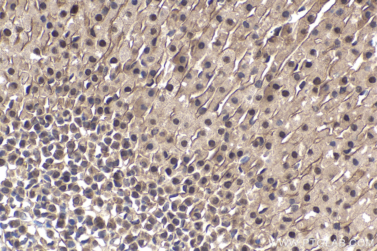 Immunohistochemical analysis of paraffin-embedded mouse adrenal gland tissue slide using KHC1898 (CIB1 IHC Kit).