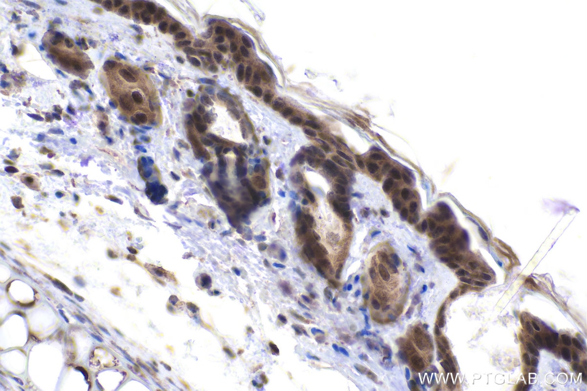 Immunohistochemical analysis of paraffin-embedded mouse skin tissue slide using KHC1898 (CIB1 IHC Kit).