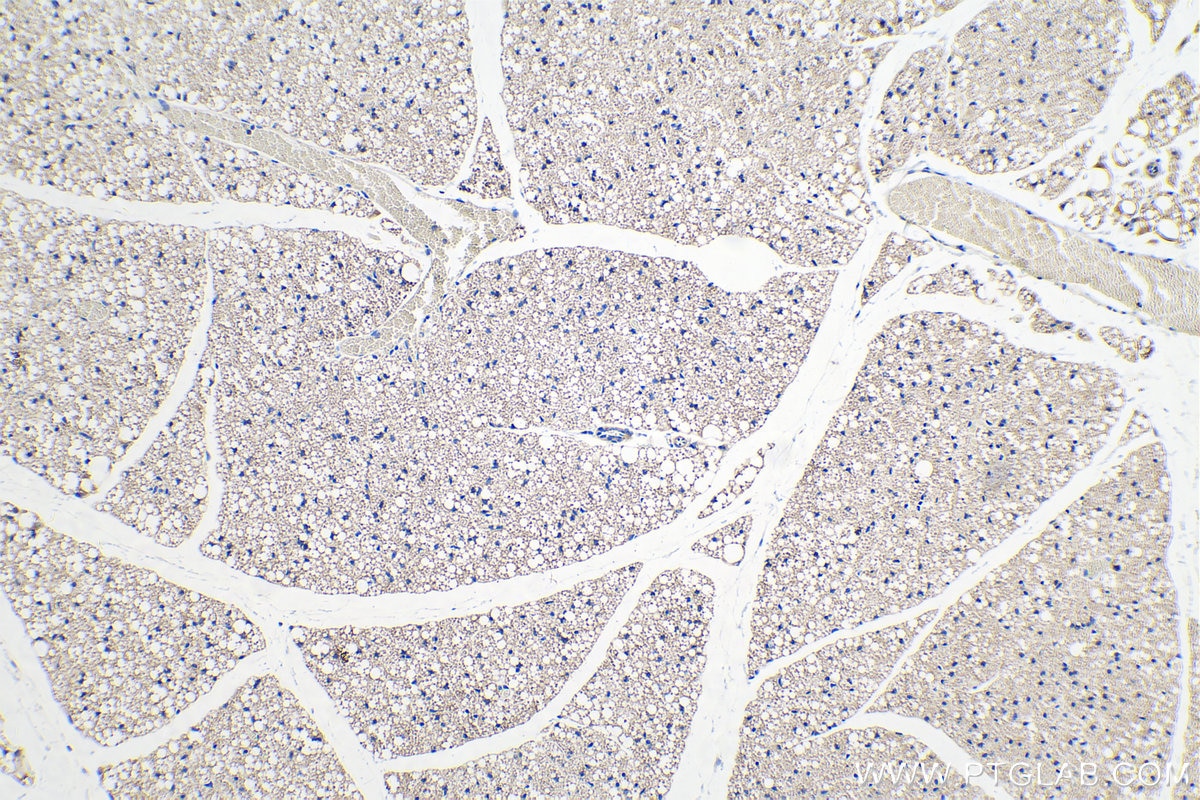 Immunohistochemical analysis of paraffin-embedded mouse brown adipose tissue slide using KHC0244 (CIDEA IHC Kit).