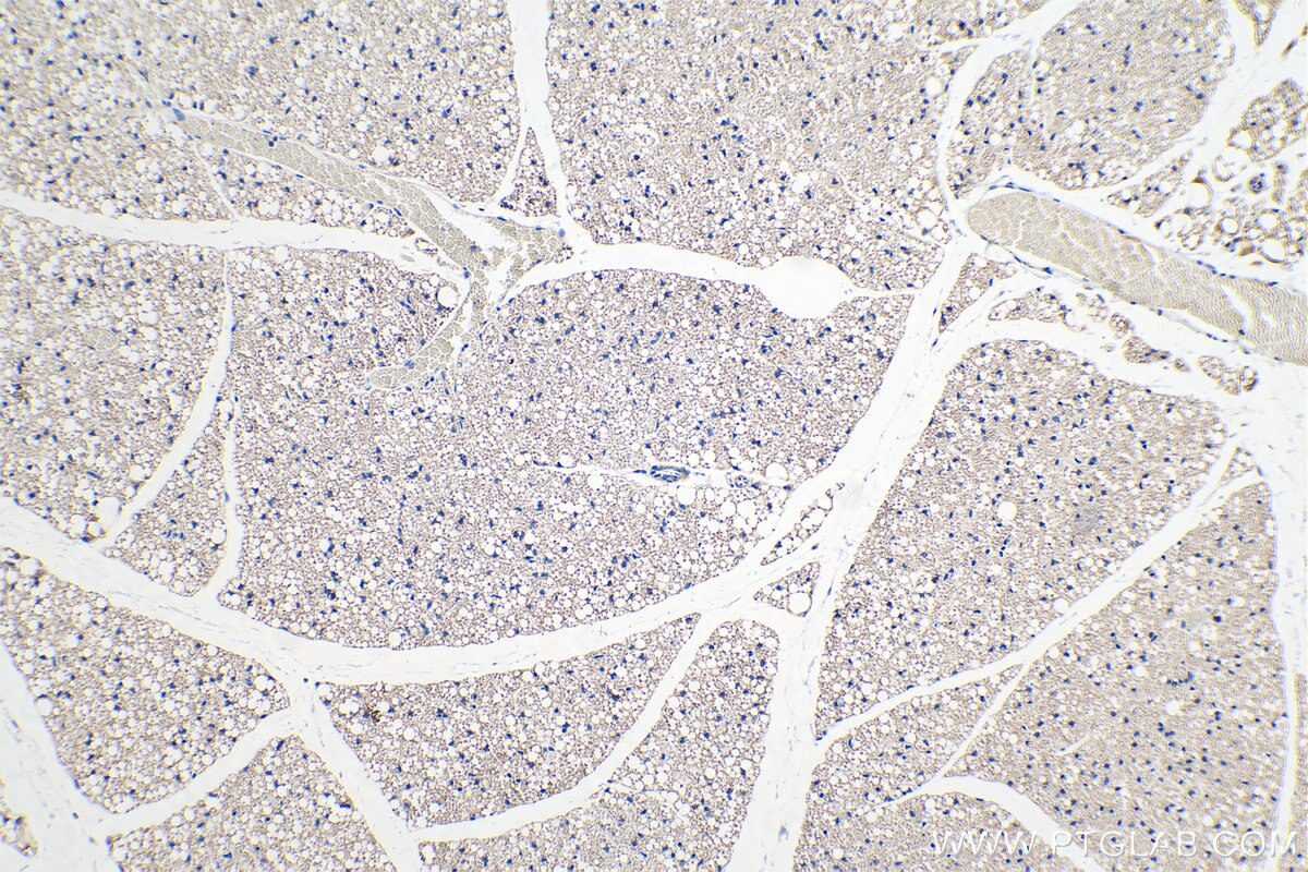 Immunohistochemical analysis of paraffin-embedded mouse brown adipose tissue slide using KHC0244 (CIDEA IHC Kit).