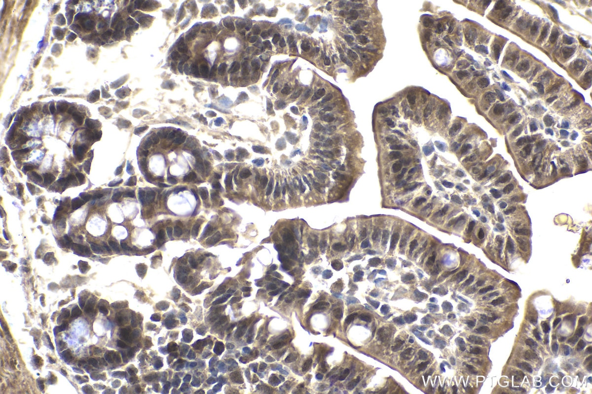 Immunohistochemical analysis of paraffin-embedded mouse small intestine tissue slide using KHC1867 (CIDEC IHC Kit).