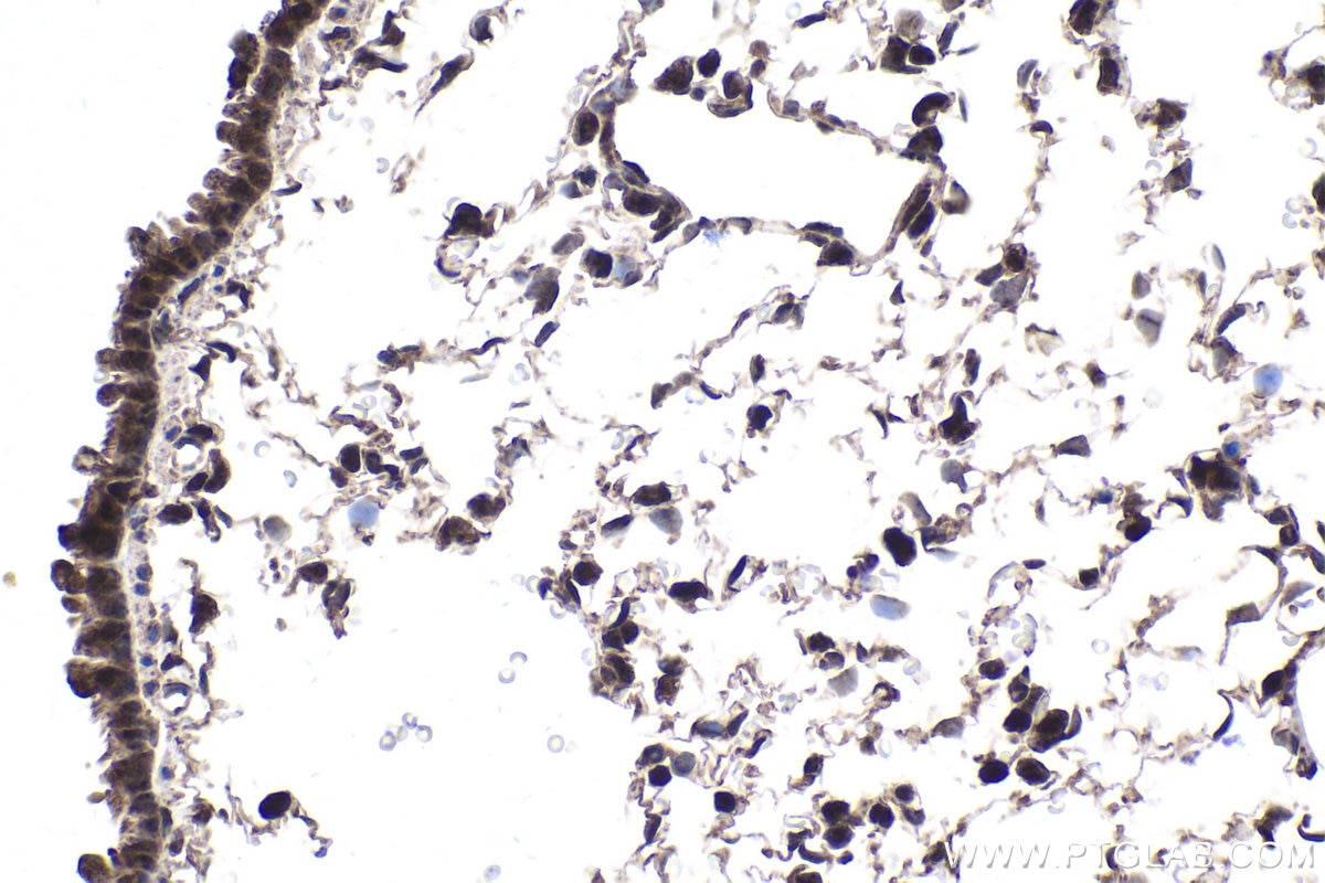 Immunohistochemical analysis of paraffin-embedded rat lung tissue slide using KHC1867 (CIDEC IHC Kit).