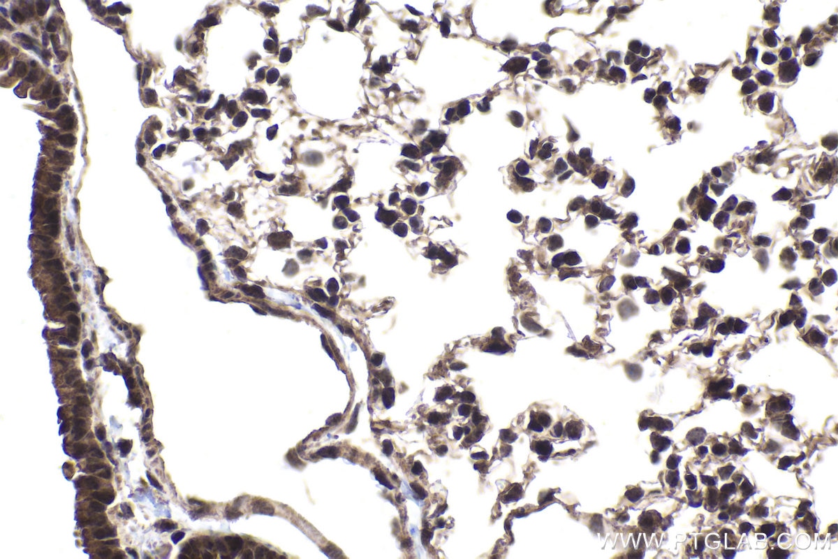 Immunohistochemical analysis of paraffin-embedded mouse lung tissue slide using KHC1867 (CIDEC IHC Kit).