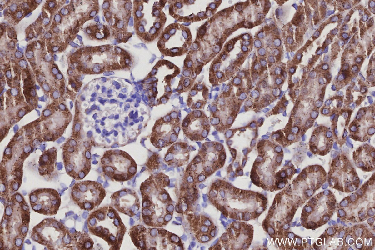 Immunohistochemical analysis of paraffin-embedded mouse kidney tissue slide using KHC2977 (CISD1 IHC Kit).