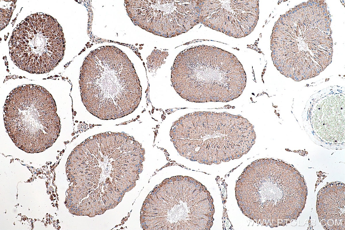 Immunohistochemical analysis of paraffin-embedded rat testis tissue slide using KHC0295 (CITED1 IHC Kit).