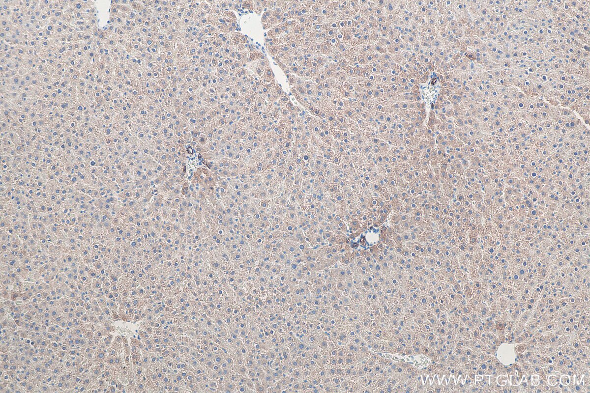 Immunohistochemical analysis of paraffin-embedded rat liver tissue slide using KHC0041 (CK8 IHC Kit).