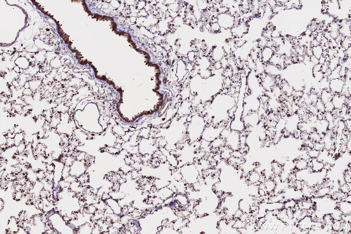 Immunohistochemical analysis of paraffin-embedded rat lung tissue slide using KHC2658 (CKAP2L IHC Kit).