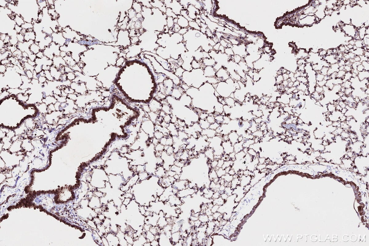 Immunohistochemical analysis of paraffin-embedded mouse lung tissue slide using KHC2658 (CKAP2L IHC Kit).
