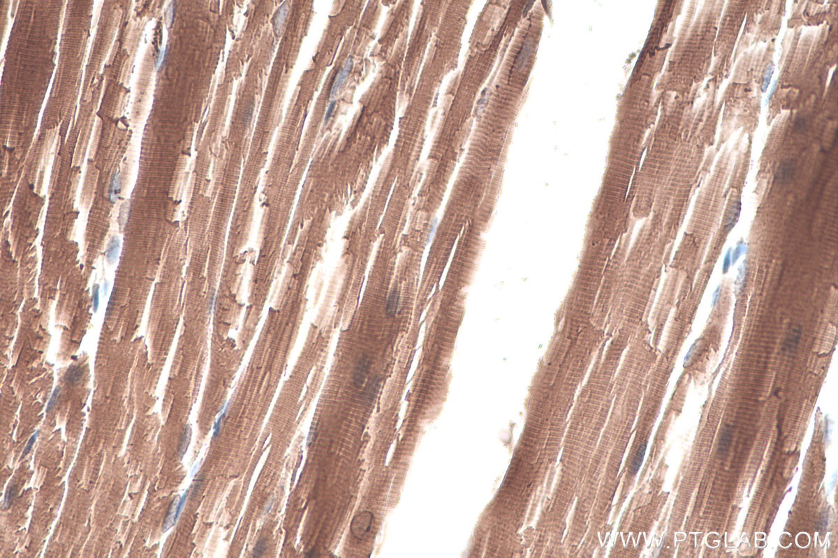 Immunohistochemical analysis of paraffin-embedded mouse skeletal muscle tissue slide using KHC0326 (CKB/CKM IHC Kit).