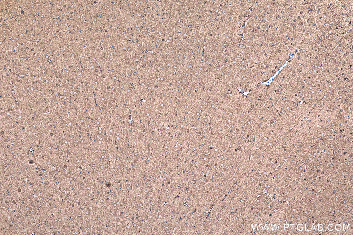 Immunohistochemical analysis of paraffin-embedded rat brain tissue slide using KHC0326 (CKB/CKM IHC Kit).