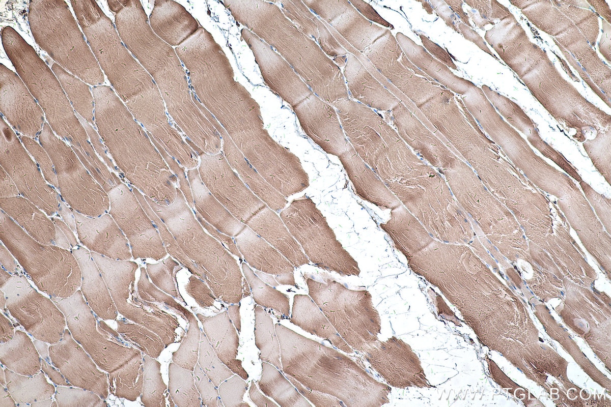 Immunohistochemical analysis of paraffin-embedded rat skeletal muscle tissue slide using KHC0326 (CKB/CKM IHC Kit).