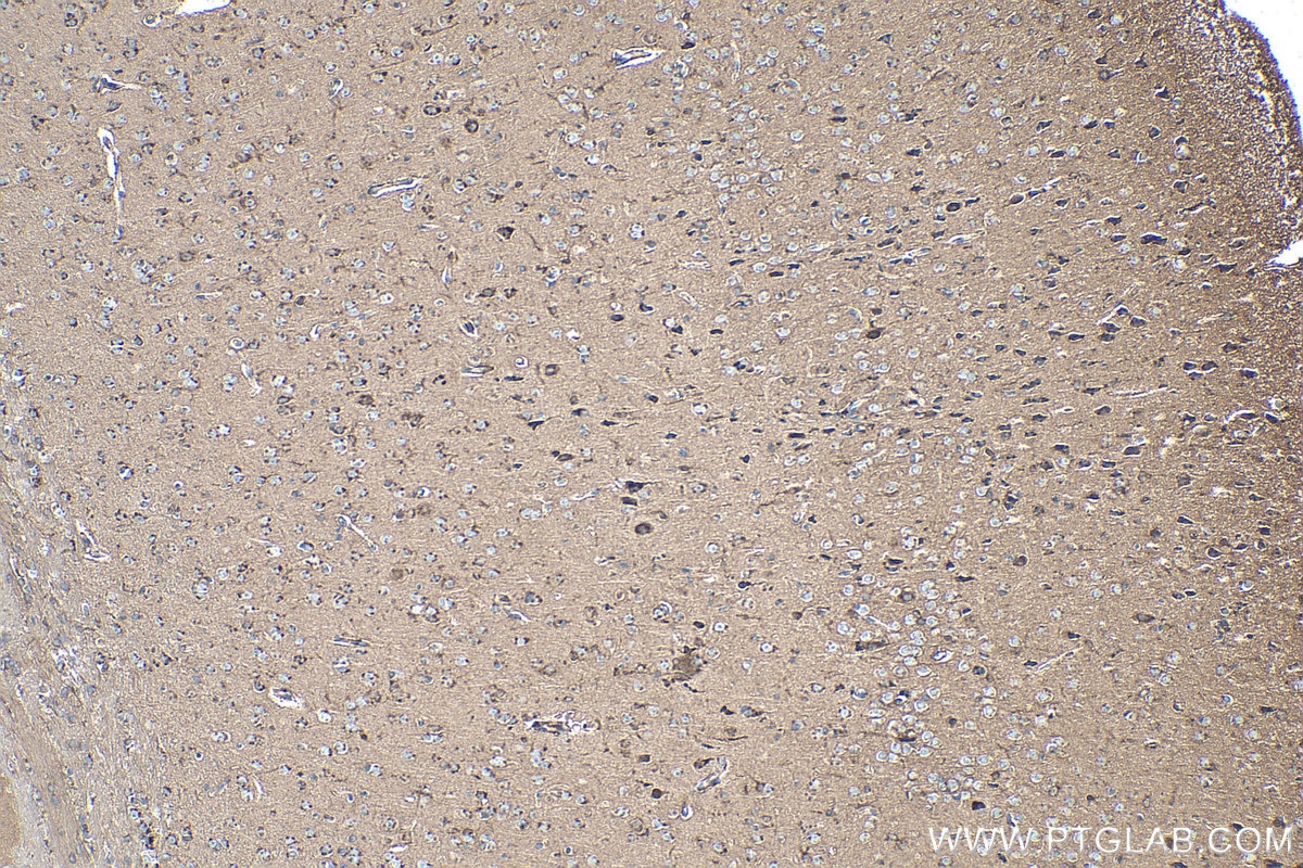 Immunohistochemical analysis of paraffin-embedded mouse brain tissue slide using KHC0325 (CKBB IHC Kit).