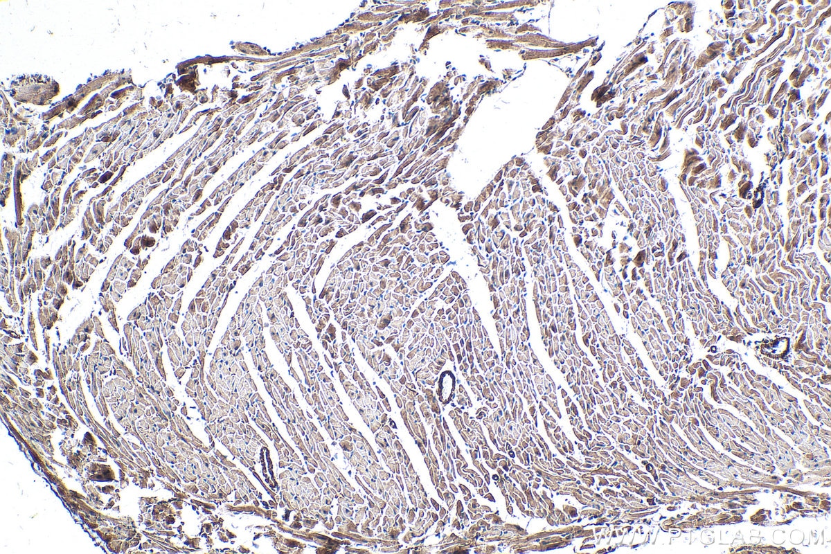 Immunohistochemical analysis of paraffin-embedded mouse heart tissue slide using KHC0325 (CKBB IHC Kit).