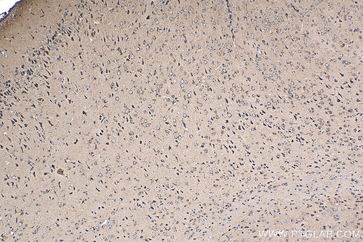 Immunohistochemical analysis of paraffin-embedded rat brain tissue slide using KHC0325 (CKBB IHC Kit).