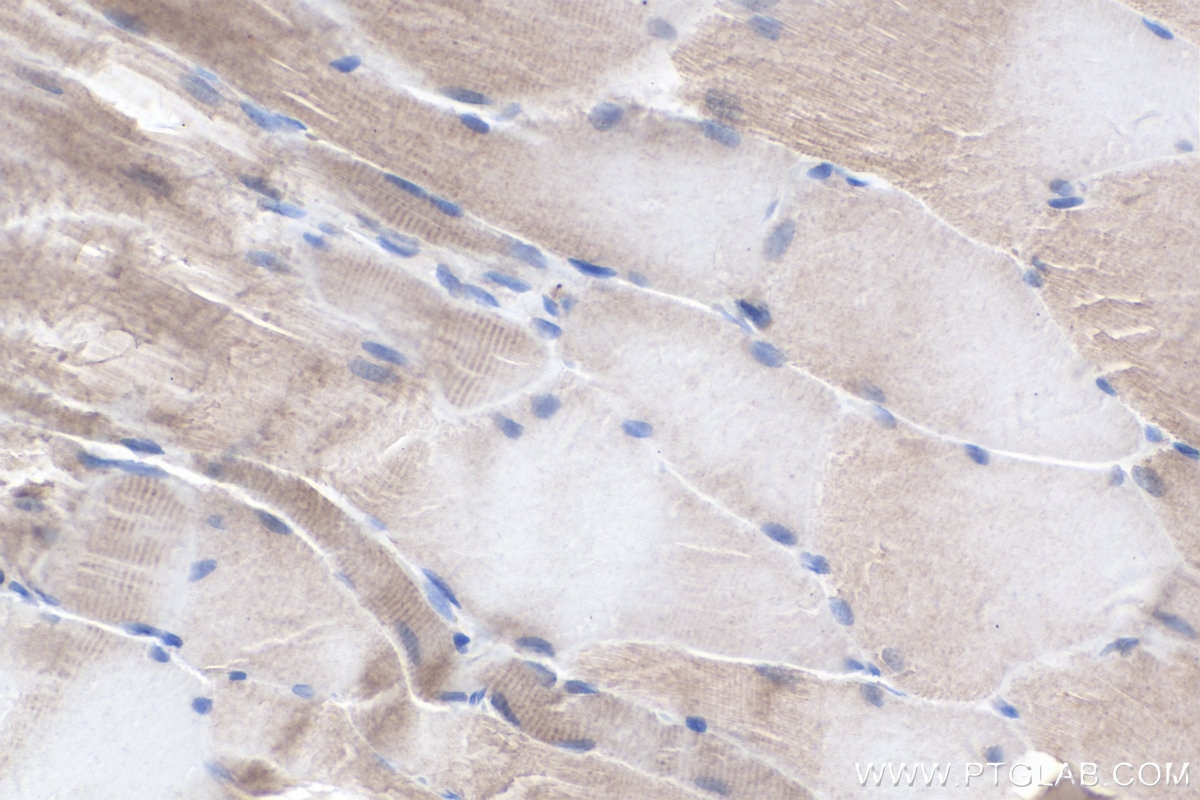 Immunohistochemical analysis of paraffin-embedded rat skeletal muscle tissue slide using KHC0325 (CKBB IHC Kit).