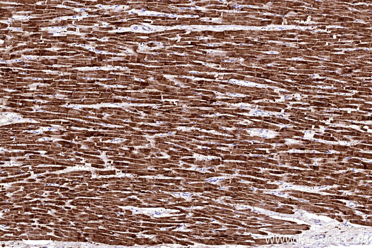 Immunohistochemical analysis of paraffin-embedded human heart tissue slide using KHC3192 (CKMT2 IHC Kit).