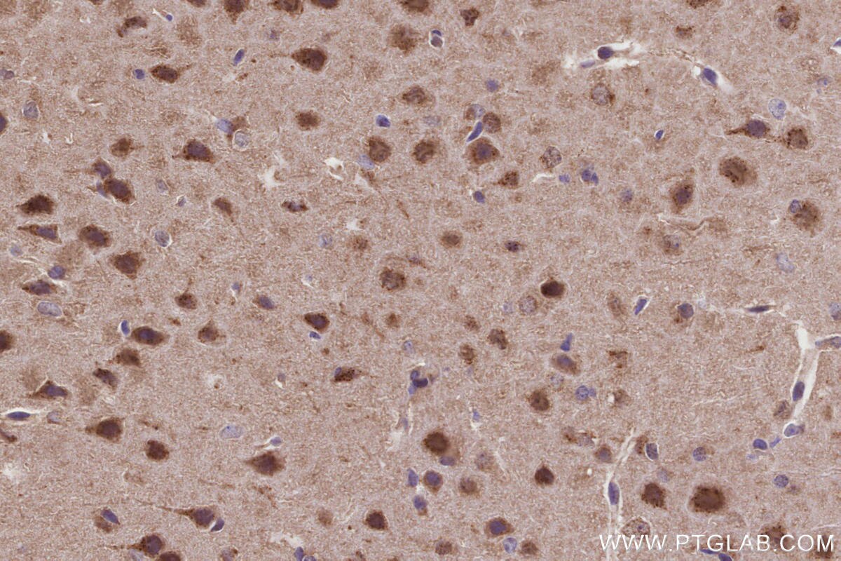 Immunohistochemical analysis of paraffin-embedded mouse brain tissue slide using KHC3223 (CLCN3 IHC Kit).