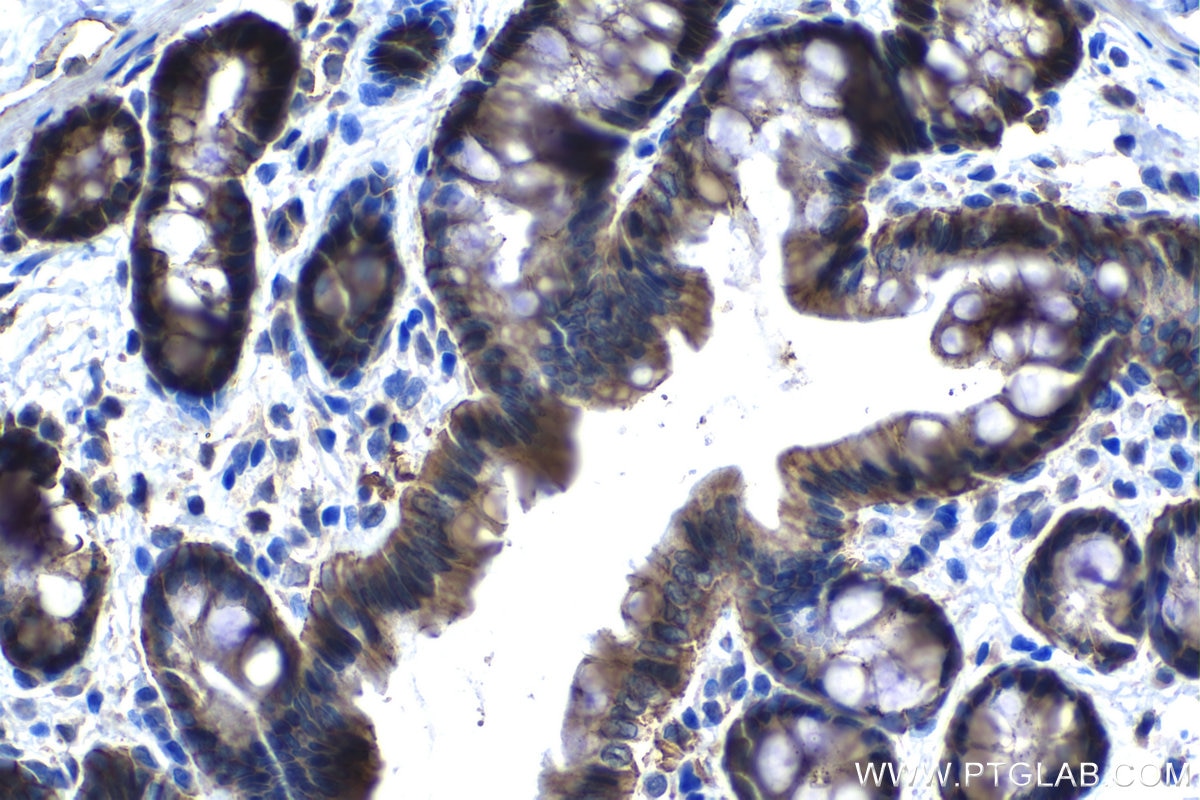 Immunohistochemical analysis of paraffin-embedded rat colon tissue slide using KHC1317 (CLDN5 IHC Kit).