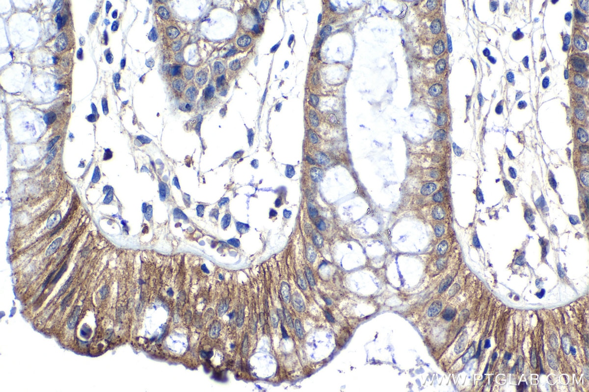 Immunohistochemical analysis of paraffin-embedded human colon tissue slide using KHC1317 (CLDN5 IHC Kit).