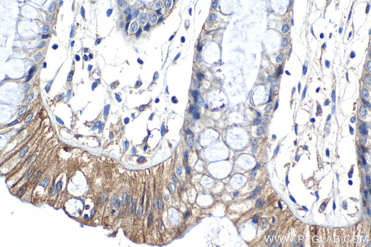 Immunohistochemical analysis of paraffin-embedded human colon tissue slide using KHC1318 (CLDN7 IHC Kit).