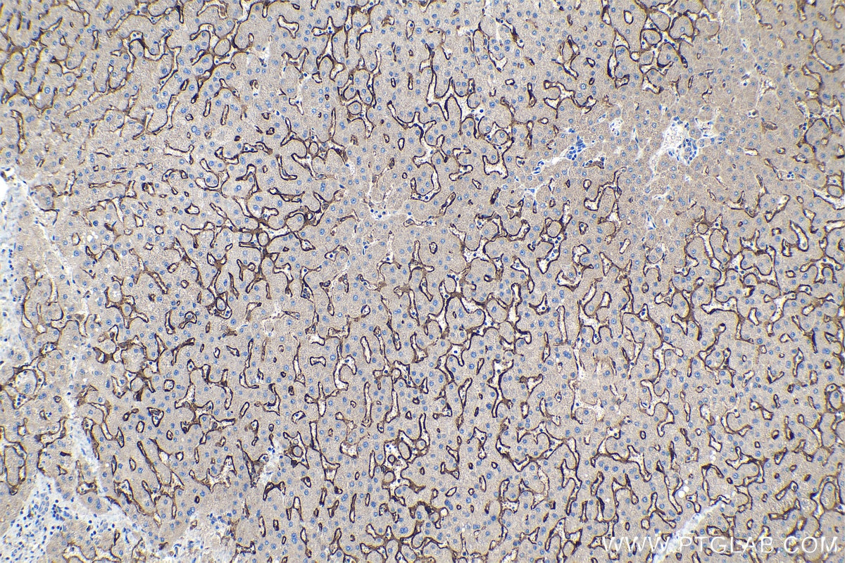 Immunohistochemical analysis of paraffin-embedded human liver tissue slide using KHC1127 (CLEC4M IHC Kit).