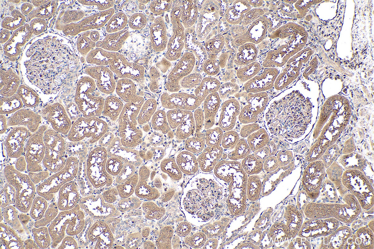 Immunohistochemical analysis of paraffin-embedded human kidney tissue slide using KHC0725 (CLIC1 IHC Kit).