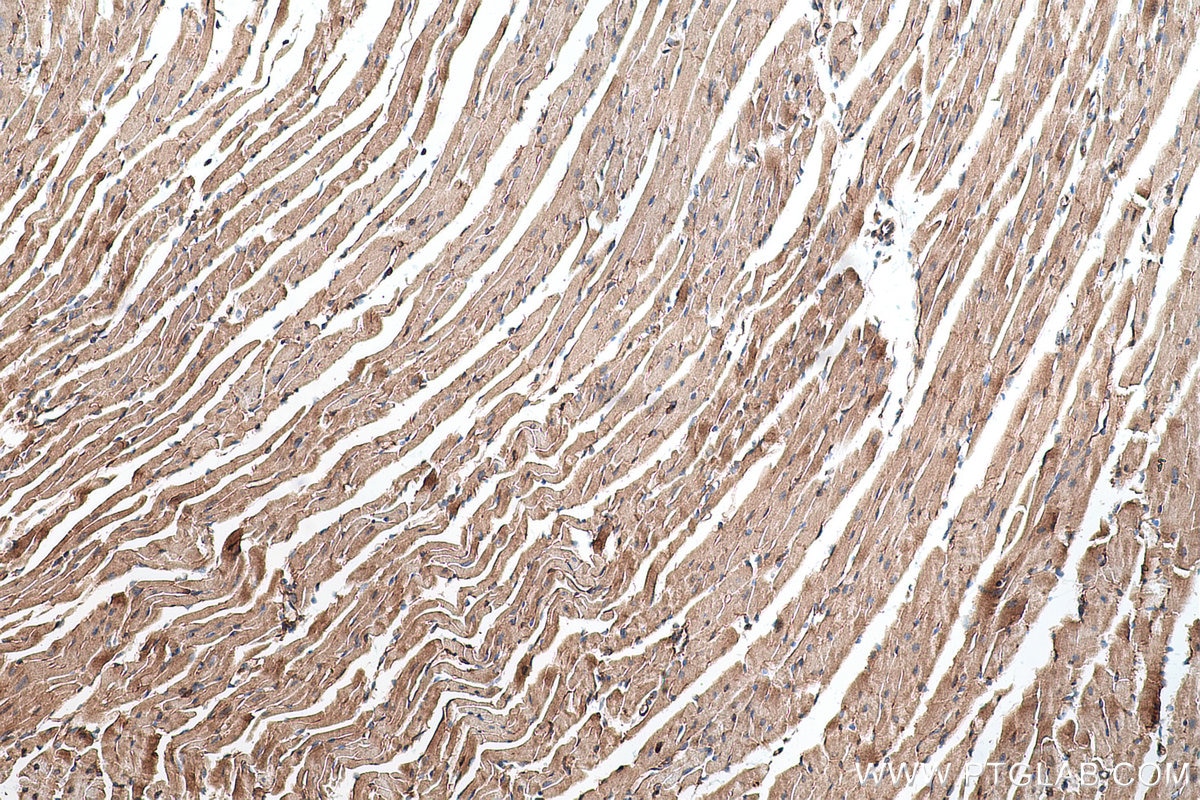 Immunohistochemical analysis of paraffin-embedded mouse heart tissue slide using KHC0725 (CLIC1 IHC Kit).