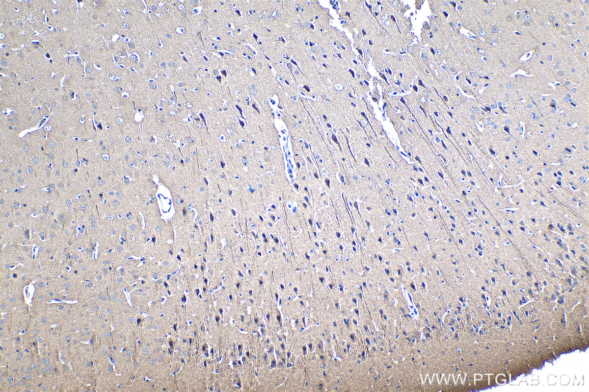 Immunohistochemical analysis of paraffin-embedded rat brain tissue slide using KHC1272 (CLIP2 IHC Kit).
