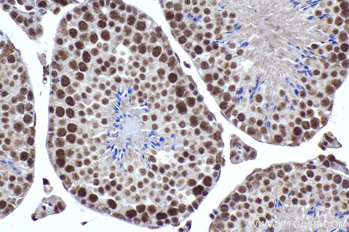Immunohistochemical analysis of paraffin-embedded mouse testis tissue slide using KHC2290 (CLK3 IHC Kit).