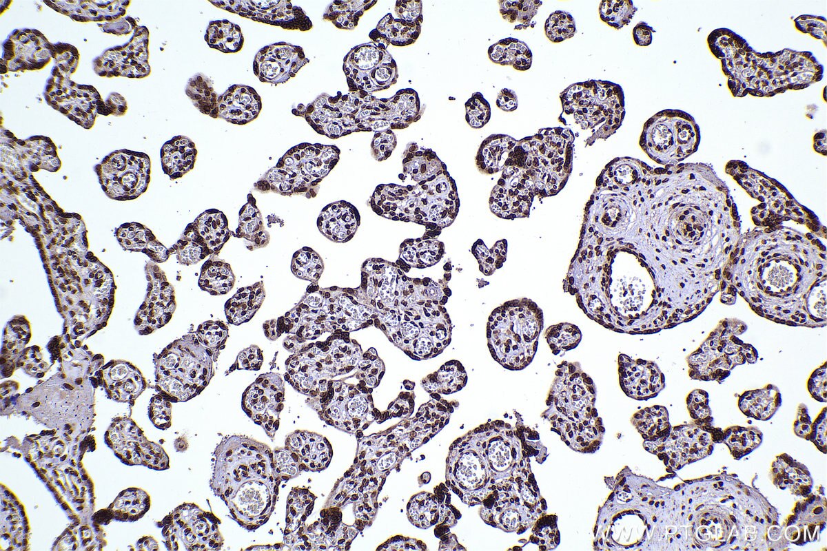 Immunohistochemical analysis of paraffin-embedded human placenta tissue slide using KHC2290 (CLK3 IHC Kit).