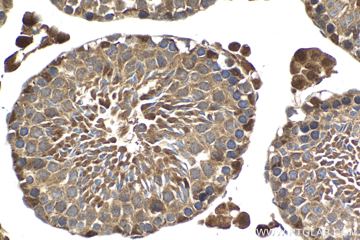 Immunohistochemical analysis of paraffin-embedded mouse testis tissue slide using KHC1447 (CLOCK IHC Kit).
