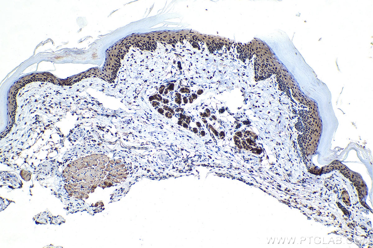 Immunohistochemical analysis of paraffin-embedded mouse skin tissue slide using KHC1447 (CLOCK IHC Kit).