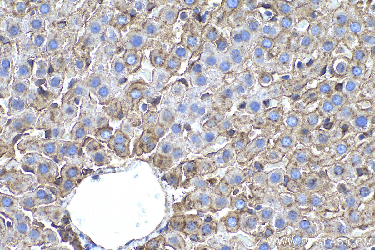 Immunohistochemical analysis of paraffin-embedded rat liver tissue slide using KHC0592 (CLTA IHC Kit).
