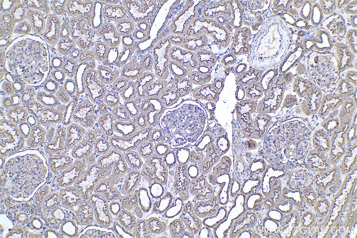 Immunohistochemical analysis of paraffin-embedded human kidney tissue slide using KHC0592 (CLTA IHC Kit).