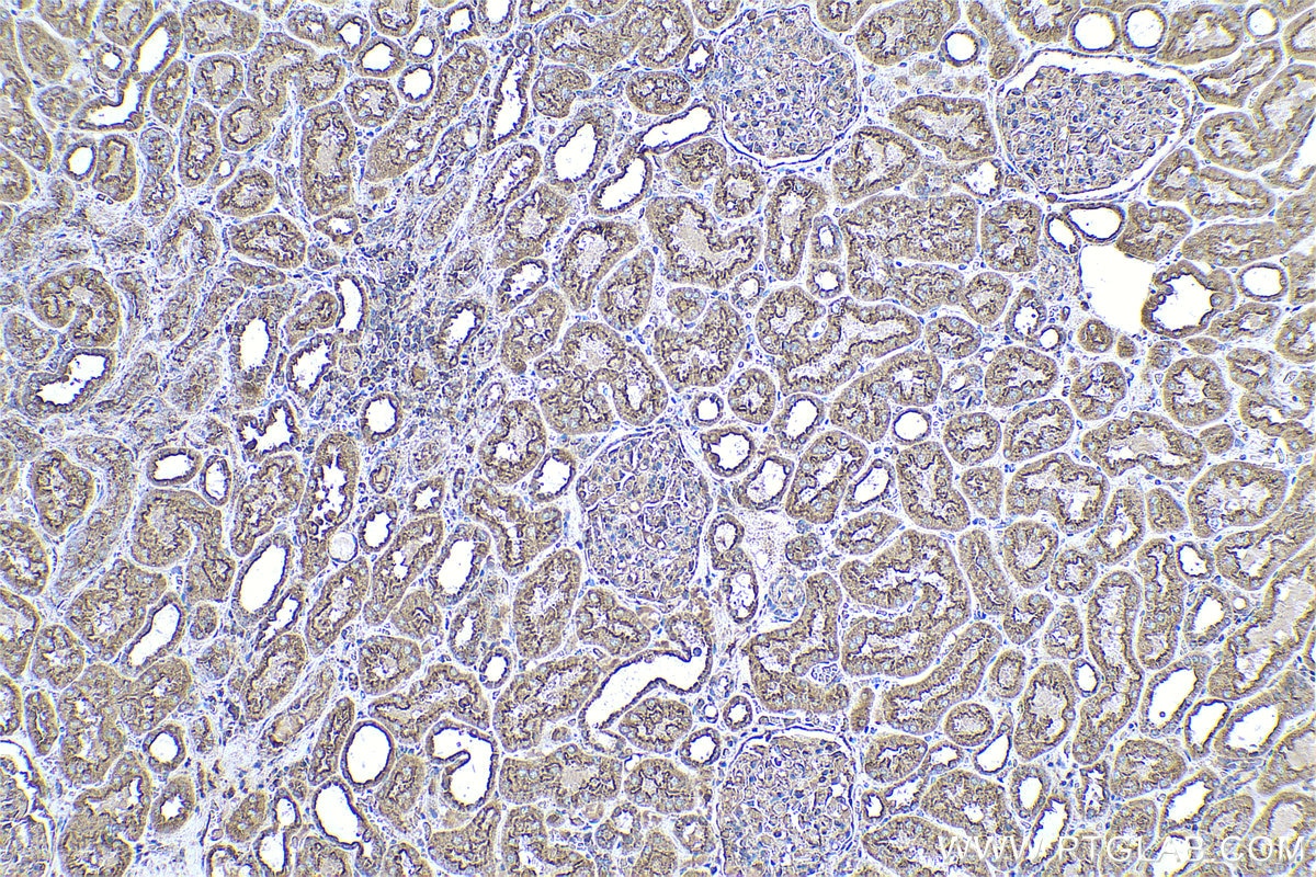 Immunohistochemical analysis of paraffin-embedded human kidney tissue slide using KHC0593 (CLTB IHC Kit).