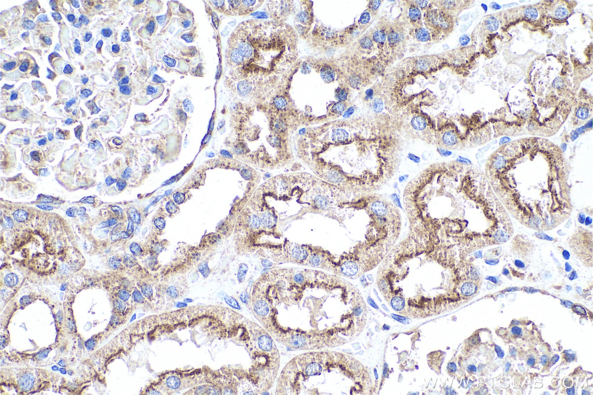 Immunohistochemical analysis of paraffin-embedded human kidney tissue slide using KHC0687 (CLTC IHC Kit).