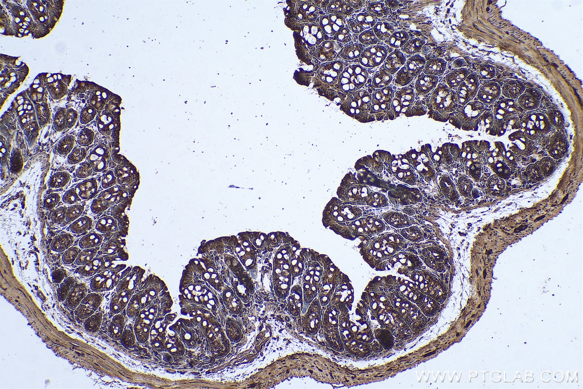 Immunohistochemical analysis of paraffin-embedded mouse colon tissue slide using KHC0687 (CLTC IHC Kit).