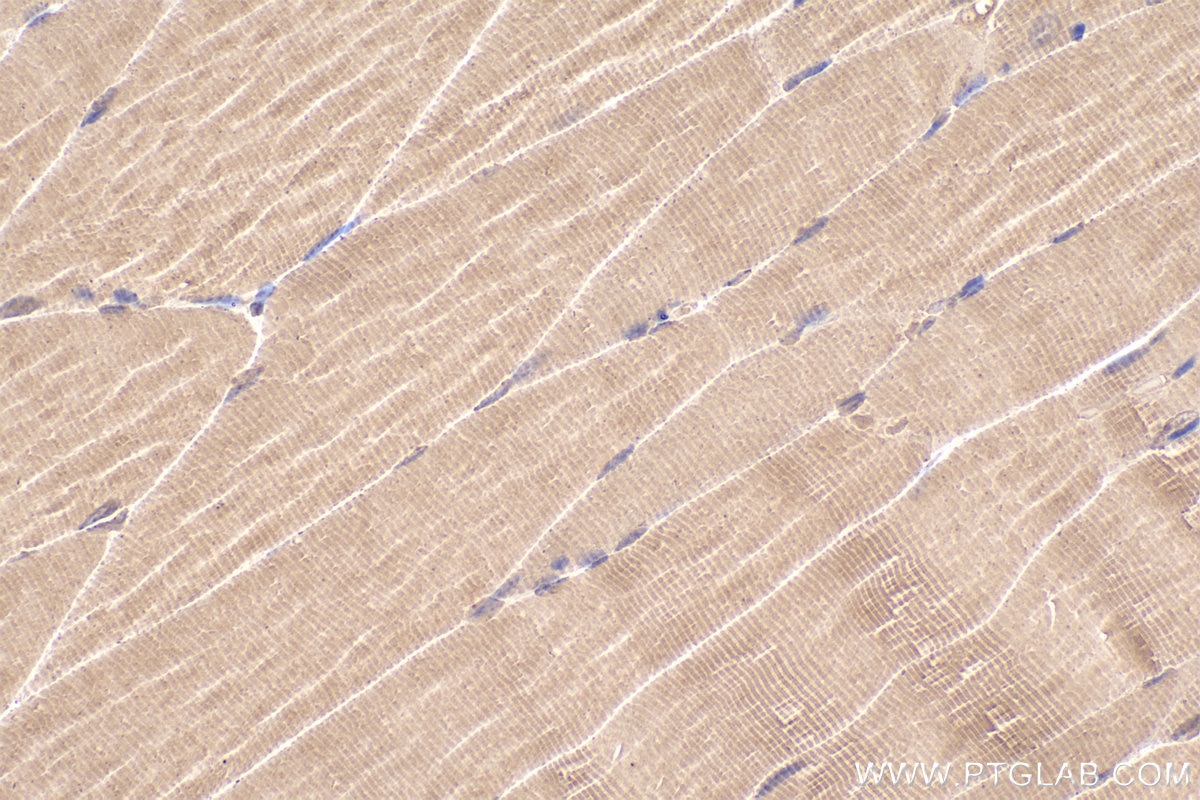 Immunohistochemical analysis of paraffin-embedded mouse skeletal muscle tissue slide using KHC2319 (CLTCL1 IHC Kit).