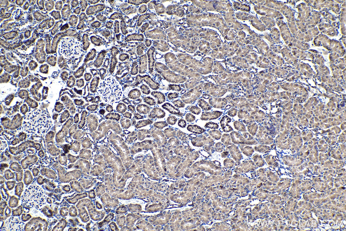 Immunohistochemical analysis of paraffin-embedded rat kidney tissue slide using KHC1392 (CLYBL IHC Kit).