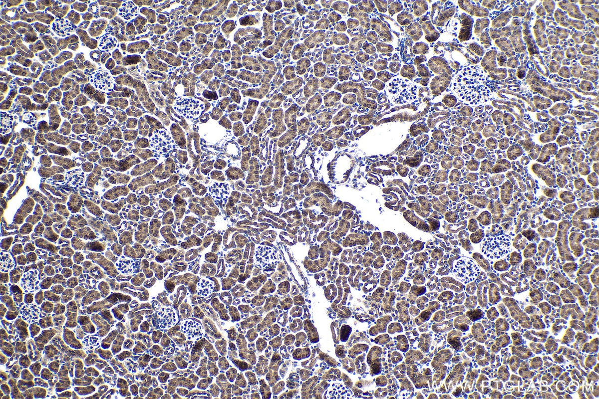 Immunohistochemical analysis of paraffin-embedded mouse kidney tissue slide using KHC1392 (CLYBL IHC Kit).