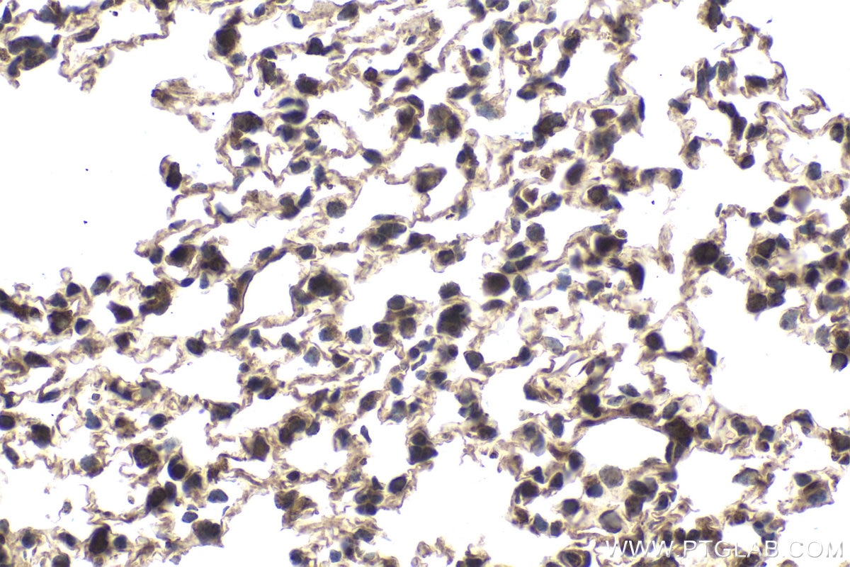 Immunohistochemical analysis of paraffin-embedded mouse lung tissue slide using KHC1823 (CMIP IHC Kit).