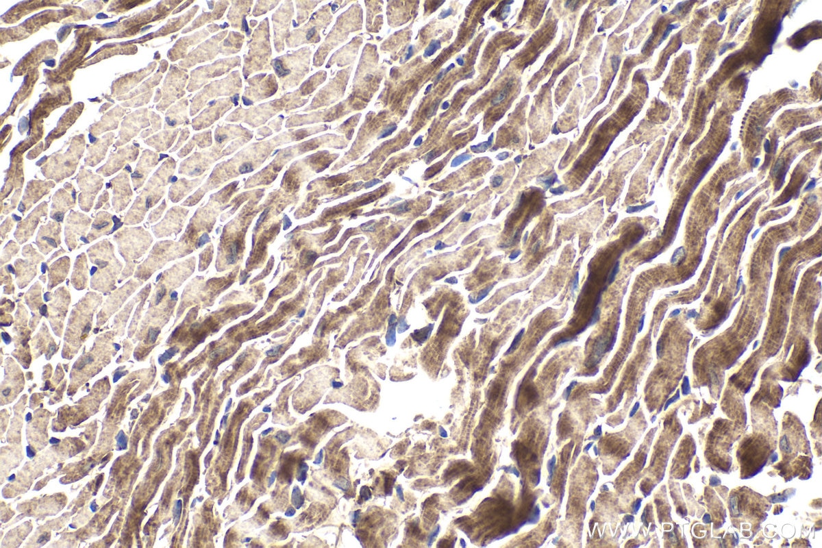 Immunohistochemical analysis of paraffin-embedded mouse heart tissue slide using KHC1823 (CMIP IHC Kit).