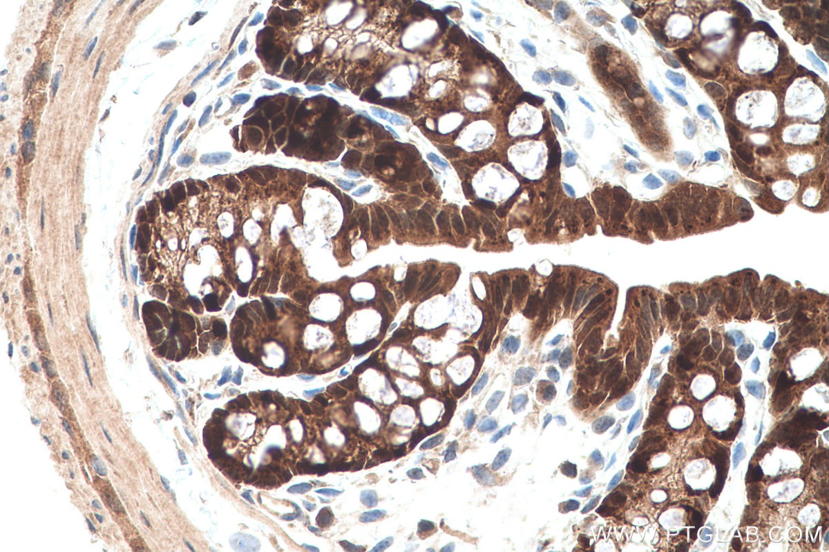 Immunohistochemical analysis of paraffin-embedded mouse colon tissue slide using KHC0727 (CMPK1 IHC Kit).