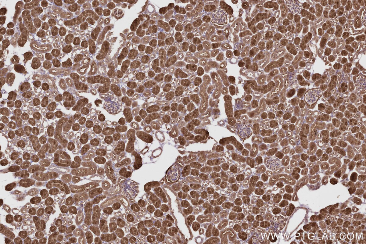 Immunohistochemical analysis of paraffin-embedded mouse kidney tissue slide using KHC2804 (CNDP2 IHC Kit).