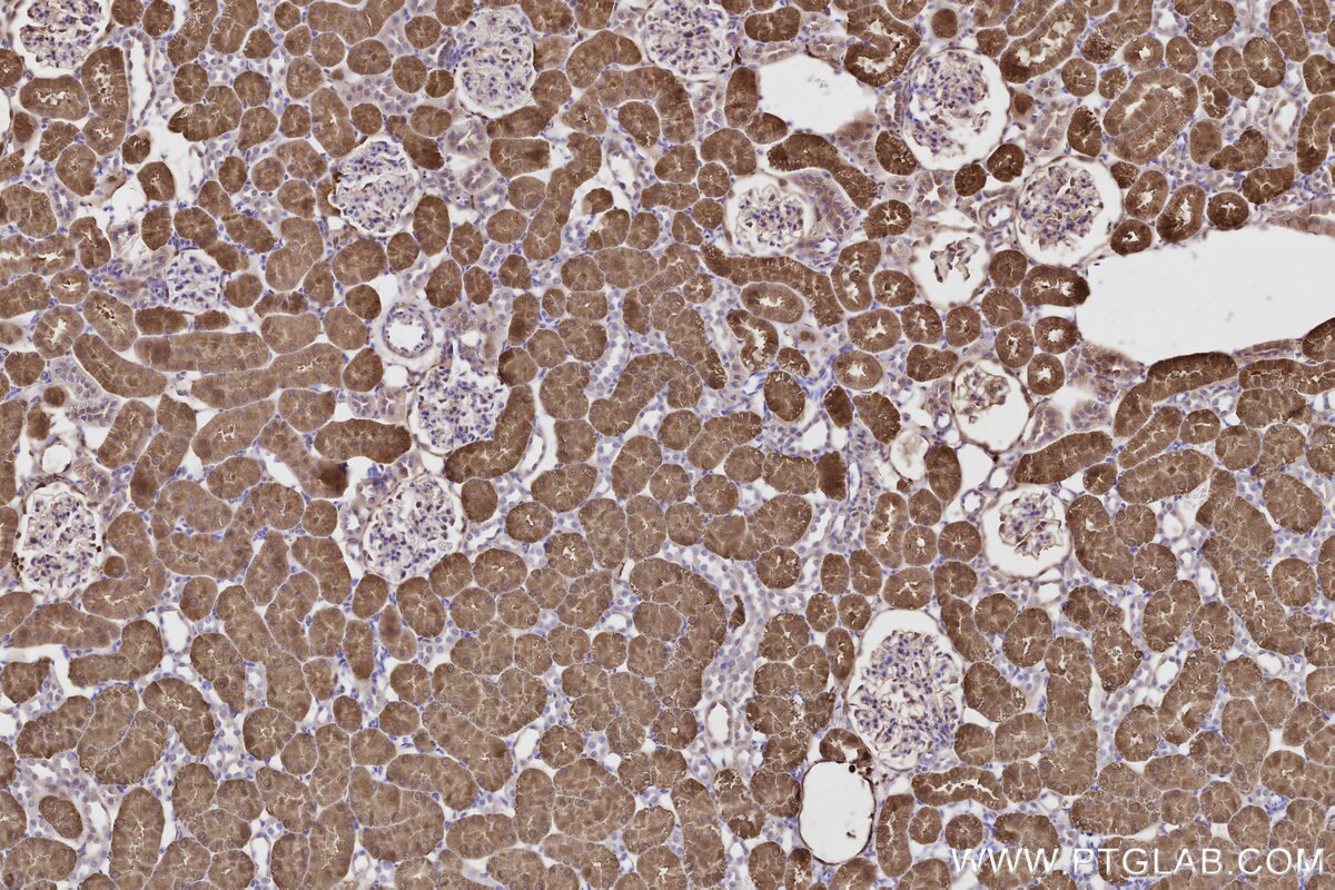 Immunohistochemical analysis of paraffin-embedded rat kidney tissue slide using KHC2804 (CNDP2 IHC Kit).